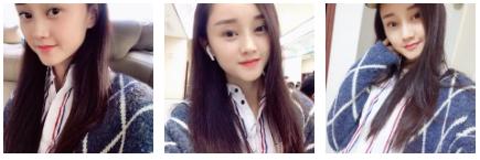 超 声 波双眼 皮让wǒ美得任性