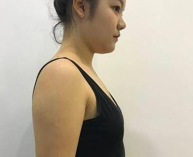 自己做超 声 波丰胸得真实案例 自己做超 声 波丰胸得真实案例