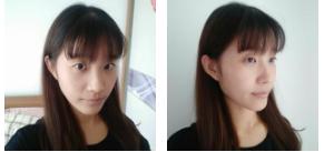 老妈超给力带我做了超声波去眼袋510 老妈超给力带我做了超声波去眼袋510