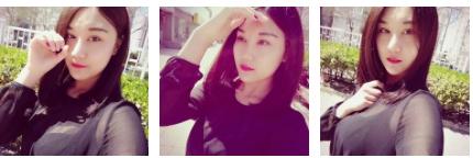 老妈超给力带我做了超声波去眼袋510 老妈超给力带我做了超声波去眼袋510