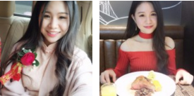 看咱们做得超 声 波去眼袋,恢复不错哦 看咱们做得超 声 波去眼袋,恢复不错哦