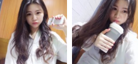 看咱们做得超 声 波去眼袋,恢复不错哦 看咱们做得超 声 波去眼袋,恢复不错哦