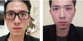 上班族长眼袋怎么办?用超声波去眼袋解决!136 上班族长眼袋怎么办?用超声波去眼袋解决!136