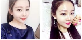 微拉美赶走“八字纹”502 微拉美赶走“八字纹”502