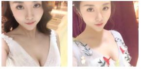 微拉美赶走“八字纹”502 微拉美赶走“八字纹”502