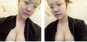 超声波自体脂肪丰胸让我更加丰满654 超声波自体脂肪丰胸让我更加丰满654