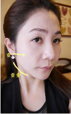 快速变美,你需要彭氏童颜术这个东西!! 快速变美,你需要彭氏童颜术这个东西!!