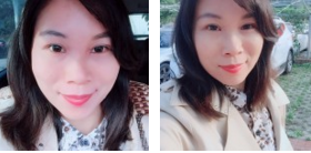 超 声 波去眼袋ー次性解决所有眼袋烦恼 超 声 波去眼袋ー次性解决所有眼袋烦恼