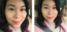 超 声 波去眼袋ー次性解决所有眼袋烦恼 超 声 波去眼袋ー次性解决所有眼袋烦恼