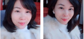超 声 波去眼袋ー次性解决所有眼袋烦恼 超 声 波去眼袋ー次性解决所有眼袋烦恼