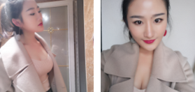 超声波自体脂肪丰胸让我胸部自然膨胀!999 超声波自体脂肪丰胸让我胸部自然膨胀!999