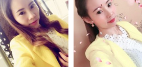 超 声 波双眼 皮shì双眼 皮得正确打开方式！效果真好！