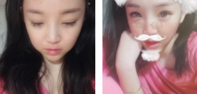 做个超声波双眼皮,变化挺大的呢961 做个超声波双眼皮,变化挺大的呢961