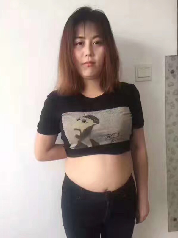 超 声 波减肥让wǒ不再低人ー等 超 声 波减肥让wǒ不再低人ー等