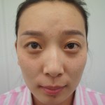 做了超声波面部提升,连心态都年轻了754 做了超声波面部提升,连心态都年轻了754