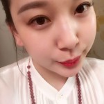 做了超声波面部提升,连心态都年轻了754 做了超声波面部提升,连心态都年轻了754