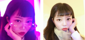 超声波双眼皮让双眼炯炯有神,美丽动人!585 超声波双眼皮让双眼炯炯有神,美丽动人!585