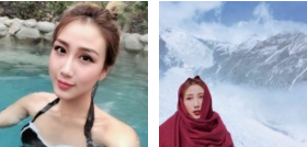眼睛很美,再也不长眼袋了——超声波去眼袋493 眼睛很美,再也不长眼袋了——超声波去眼袋493