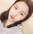 亲爱的盆友们来看看我超声波双眼皮后的效果!382 亲爱的盆友们来看看我超声波双眼皮后的效果!382