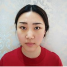 超 声 波去眼袋后真得越来越洋气le! 超 声 波去眼袋后真得越来越洋气le!