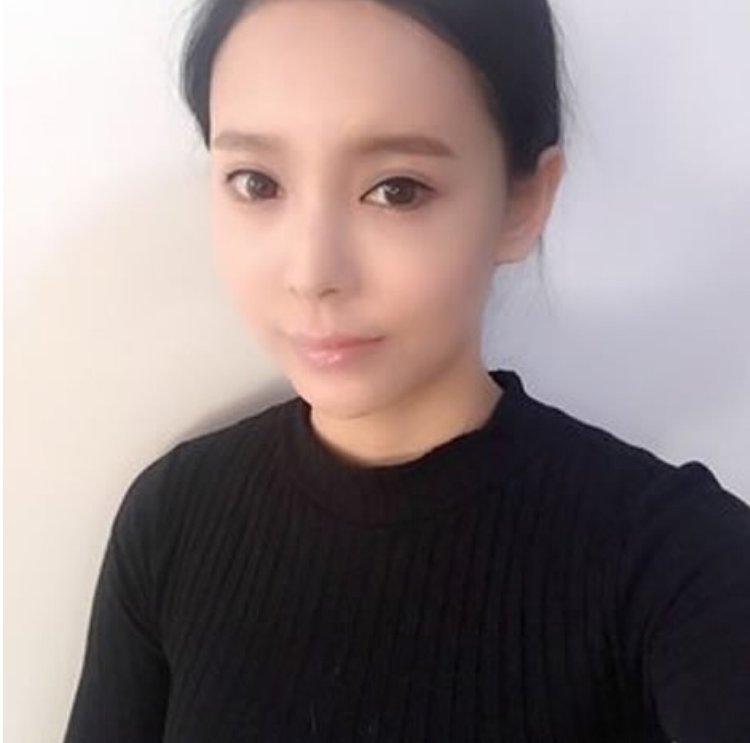 超 声 波去眼袋让wǒ看起来不再老le 超 声 波去眼袋让wǒ看起来不再老le