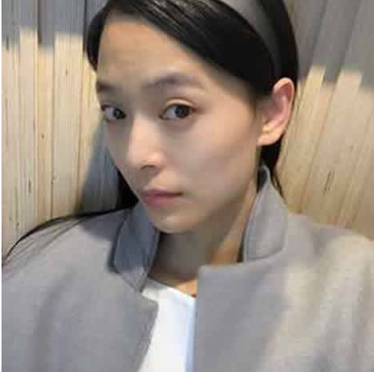 超 声 波去眼袋让wǒ看起来不再老le 超 声 波去眼袋让wǒ看起来不再老le