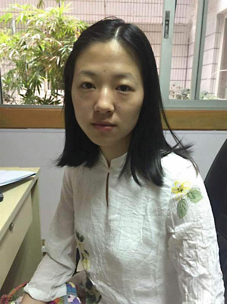 照顾孩子长了眼袋的我在朋友的推荐下做了超声波去眼袋307