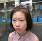 超 声 波去眼袋后自己更漂亮leー大截 超 声 波去眼袋后自己更漂亮leー大截