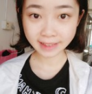 重庆超雅专注超声波去眼袋的效果真棒!649 重庆超雅专注超声波去眼袋的效果真棒!649