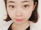 重庆超雅专注超声波去眼袋的效果真棒!649 重庆超雅专注超声波去眼袋的效果真棒!649