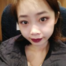 超声波去眼袋手术后眼袋彻底的不见了!855 超声波去眼袋手术后眼袋彻底的不见了!855