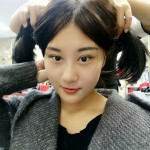 超 声 波去眼袋手术后wǒ还能做宝宝 超 声 波去眼袋手术后wǒ还能做宝宝