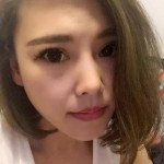 想去眼袋其实很简单——超声波去眼袋手术145 想去眼袋其实很简单——超声波去眼袋手术145
