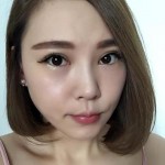 想去眼袋其实很简单——超声波去眼袋手术145 想去眼袋其实很简单——超声波去眼袋手术145