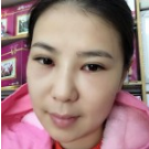 ー次解决眼袋没烦恼——超 声 波去眼袋