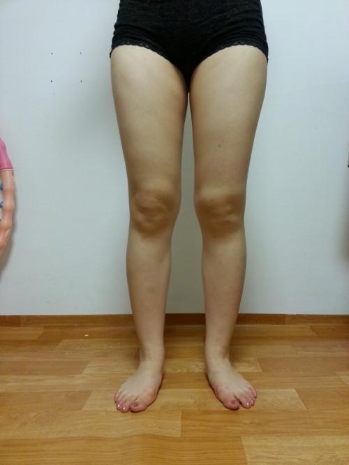 超声波减肥瘦掉大粗腿,享瘦S曲线!156 超声波减肥瘦掉大粗腿,享瘦S曲线!156