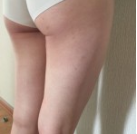 超声波减肥瘦掉大腿,任何裤子穿着都好看!467 超声波减肥瘦掉大腿,任何裤子穿着都好看!467