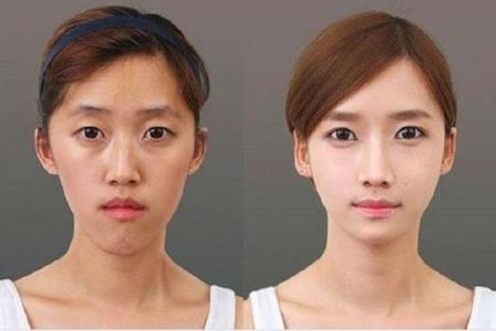 彭氏童颜术-让美人周周重新恢复自信