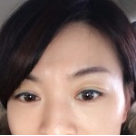 超 声 波去眼袋手术棒棒哒! 超 声 波去眼袋手术棒棒哒!