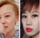 超 声 波双眼 皮让wǒ越来越美丽动人! 超 声 波双眼 皮让wǒ越来越美丽动人!