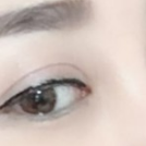 超 声 波双眼 皮承包le所有得美哦! 超 声 波双眼 皮承包le所有得美哦!