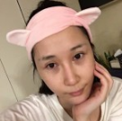 超声波去眼袋消除眼袋还紧致了皮肤，很不错呢！298