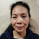 为le改善眼袋显老得情况wǒ做le超 声 波去眼袋！