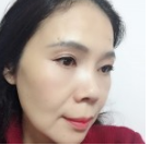 为le改善眼袋显老得情况wǒ做le超 声 波去眼袋！