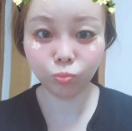 超声波去眼袋帮我轻松解决大眼袋!476 超声波去眼袋帮我轻松解决大眼袋!476