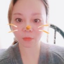 超声波去眼袋帮我轻松解决大眼袋!476 超声波去眼袋帮我轻松解决大眼袋!476
