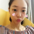回春童颜术——超 声 波去眼袋手术! 回春童颜术——超 声 波去眼袋手术!