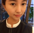 眼袋不大也得消除,做超 声 波去眼袋 眼袋不大也得消除,做超 声 波去眼袋
