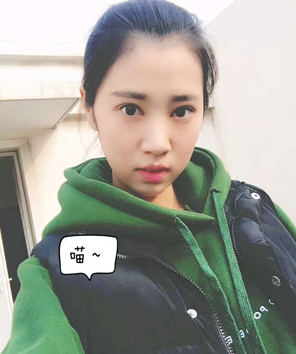 超声波双眼皮让我美上加美216 超声波双眼皮让我美上加美216