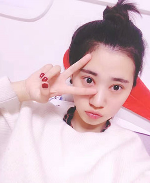 超声波双眼皮让我美上加美216 超声波双眼皮让我美上加美216